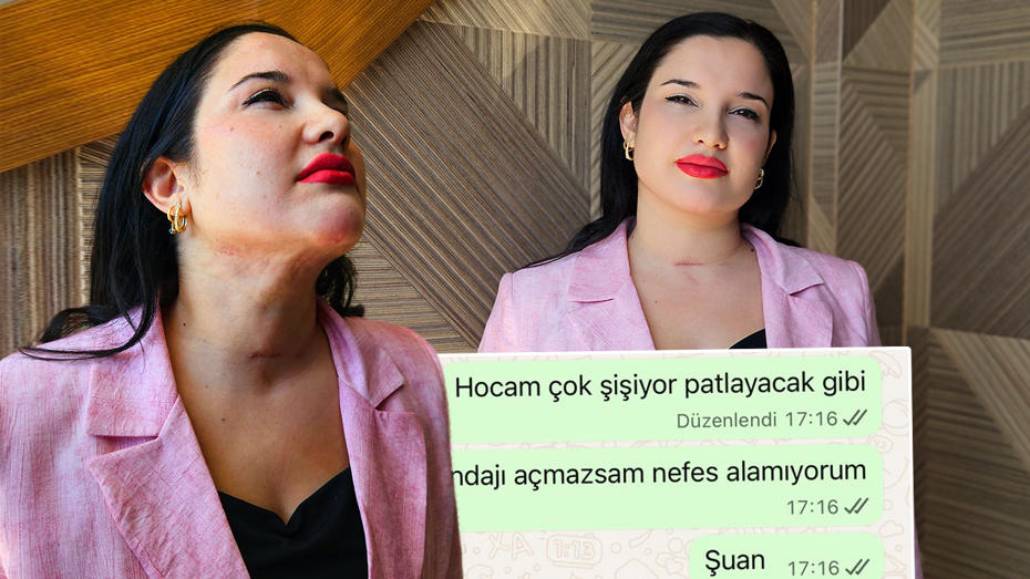 Estetik Operasyonundan Sonra Yaşanan Sağlık Sorunları ve Hukuki Mücadele