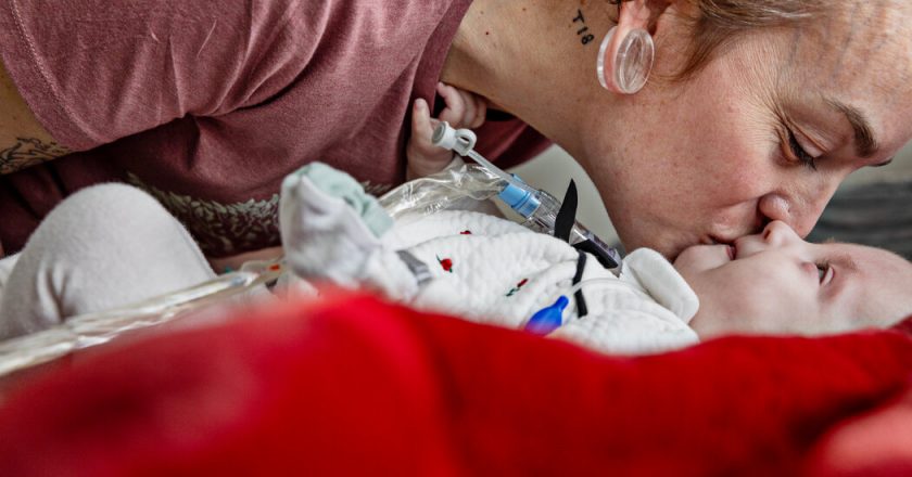 How 2 Families Faced a Catastrophic Birth Defect