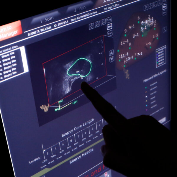 Why Some Physicians Believe Certain Cancers Should Remain Untreated