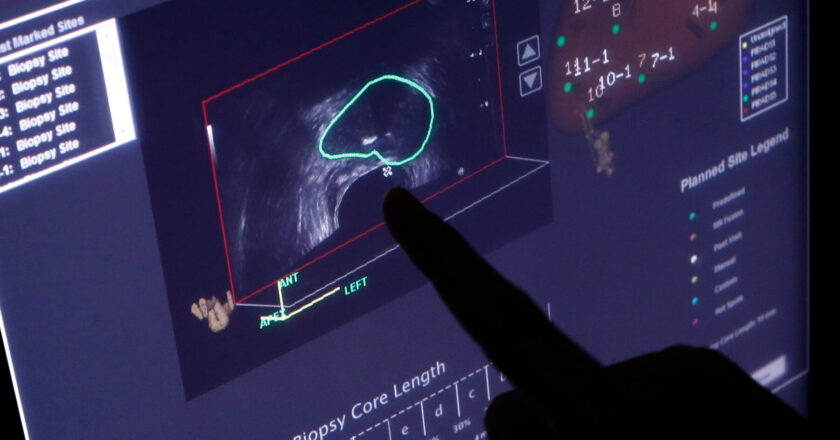 Why Some Physicians Believe Certain Cancers Should Remain Untreated